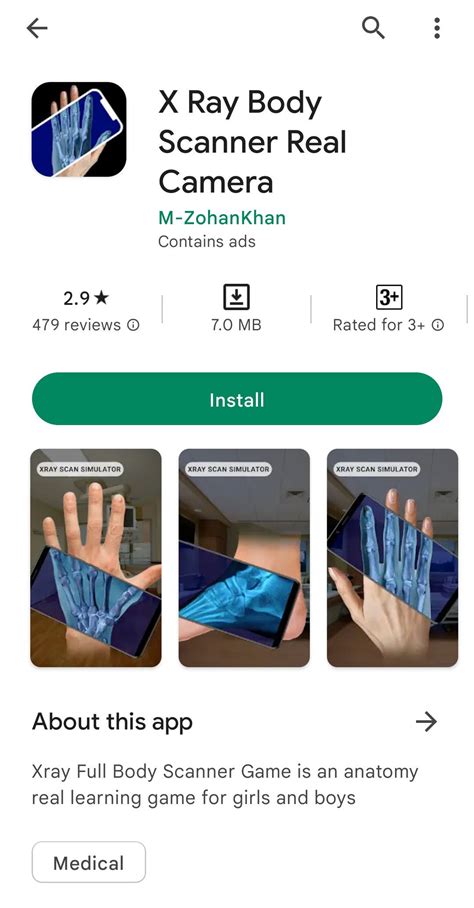 why are there so many fake x ray apps